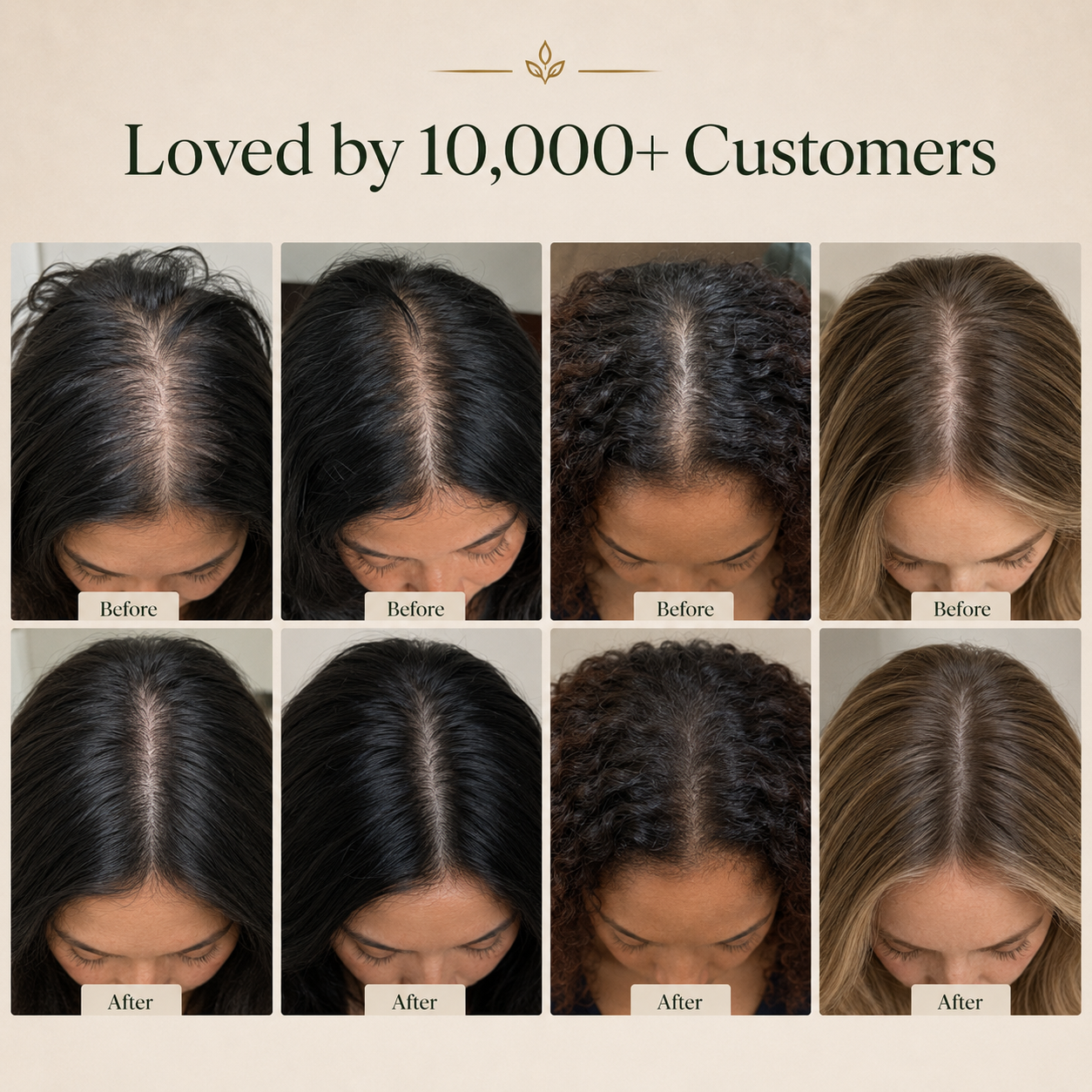 Korean Scalp Reset Bar